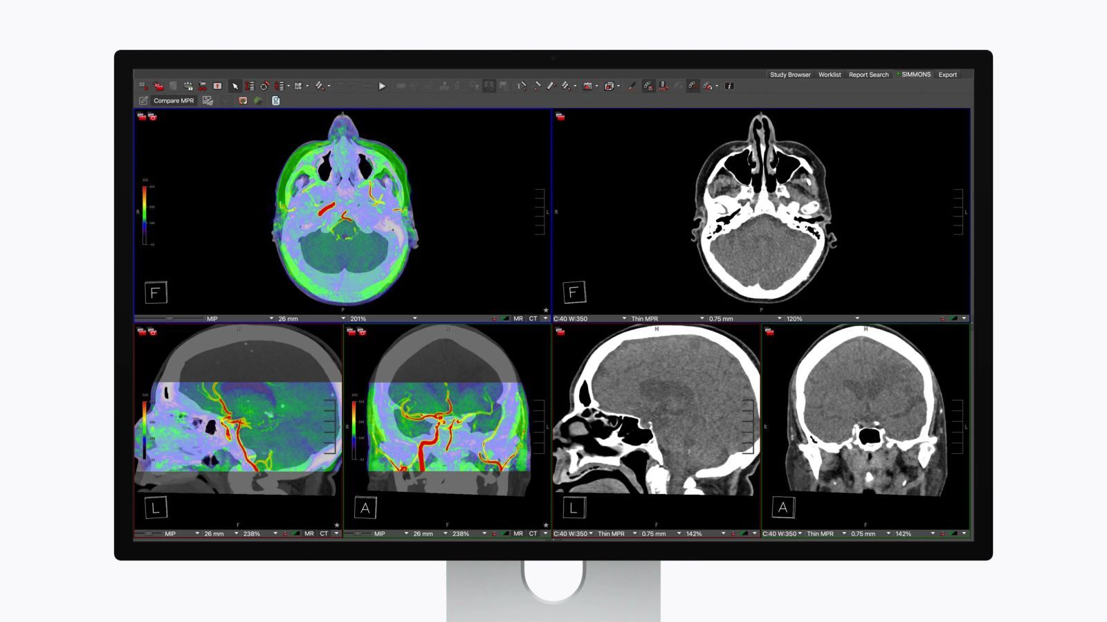Studio Display XDR : la fonction Medical Imaging Calibrator obtient l’approbation de la FDA